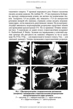 Neurosurgery: a textbook / V.O. Piatykop, I.O. Kutovyi, A.V. Kozachenko et al.