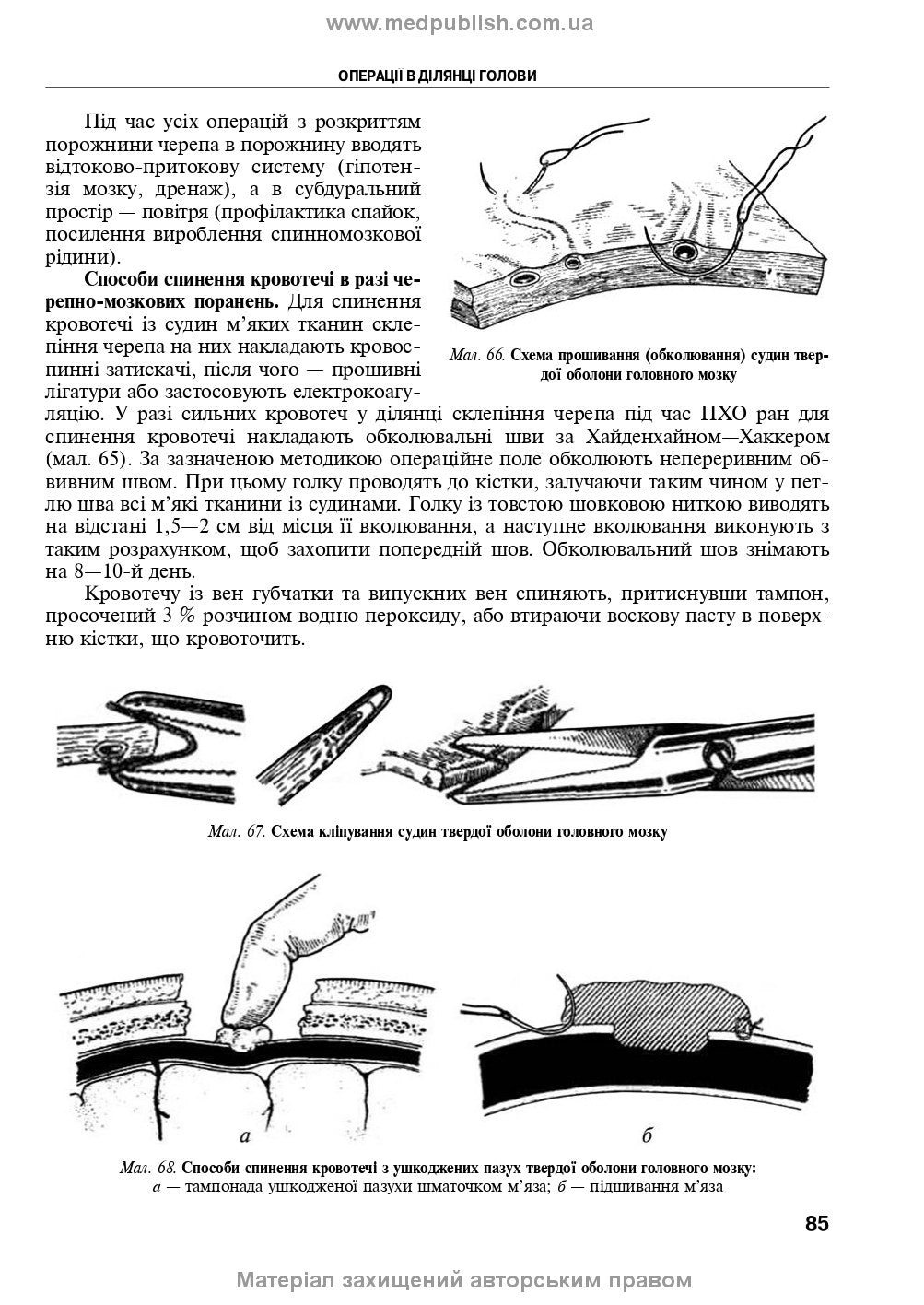 Operative Surgery and Topographic Anatomy: Textbook / Yu.T. Akhtemiichuk, Yu.M. Vovk, S.V. Doroshenko, et al. — 5th edition