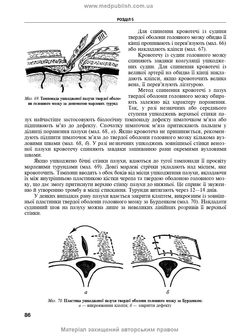 Operative Surgery and Topographic Anatomy: Textbook / Yu.T. Akhtemiichuk, Yu.M. Vovk, S.V. Doroshenko, et al. — 5th edition