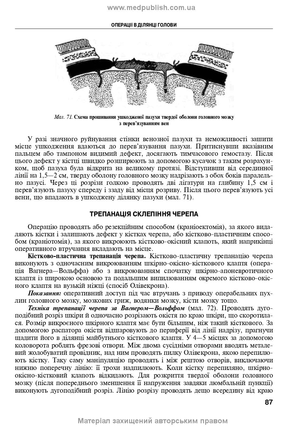 Operative Surgery and Topographic Anatomy: Textbook / Yu.T. Akhtemiichuk, Yu.M. Vovk, S.V. Doroshenko, et al. — 5th edition