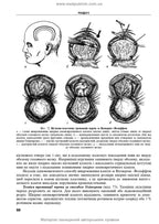 Operative Surgery and Topographic Anatomy: Textbook / Yu.T. Akhtemiichuk, Yu.M. Vovk, S.V. Doroshenko, et al. — 5th edition