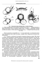 Operative Surgery and Topographic Anatomy: Textbook / Yu.T. Akhtemiichuk, Yu.M. Vovk, S.V. Doroshenko, et al. — 5th edition