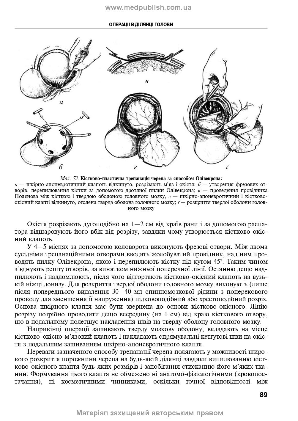 Operative Surgery and Topographic Anatomy: Textbook / Yu.T. Akhtemiichuk, Yu.M. Vovk, S.V. Doroshenko, et al. — 5th edition