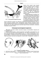 Operative Surgery and Topographic Anatomy: Textbook / Yu.T. Akhtemiichuk, Yu.M. Vovk, S.V. Doroshenko, et al. — 5th edition