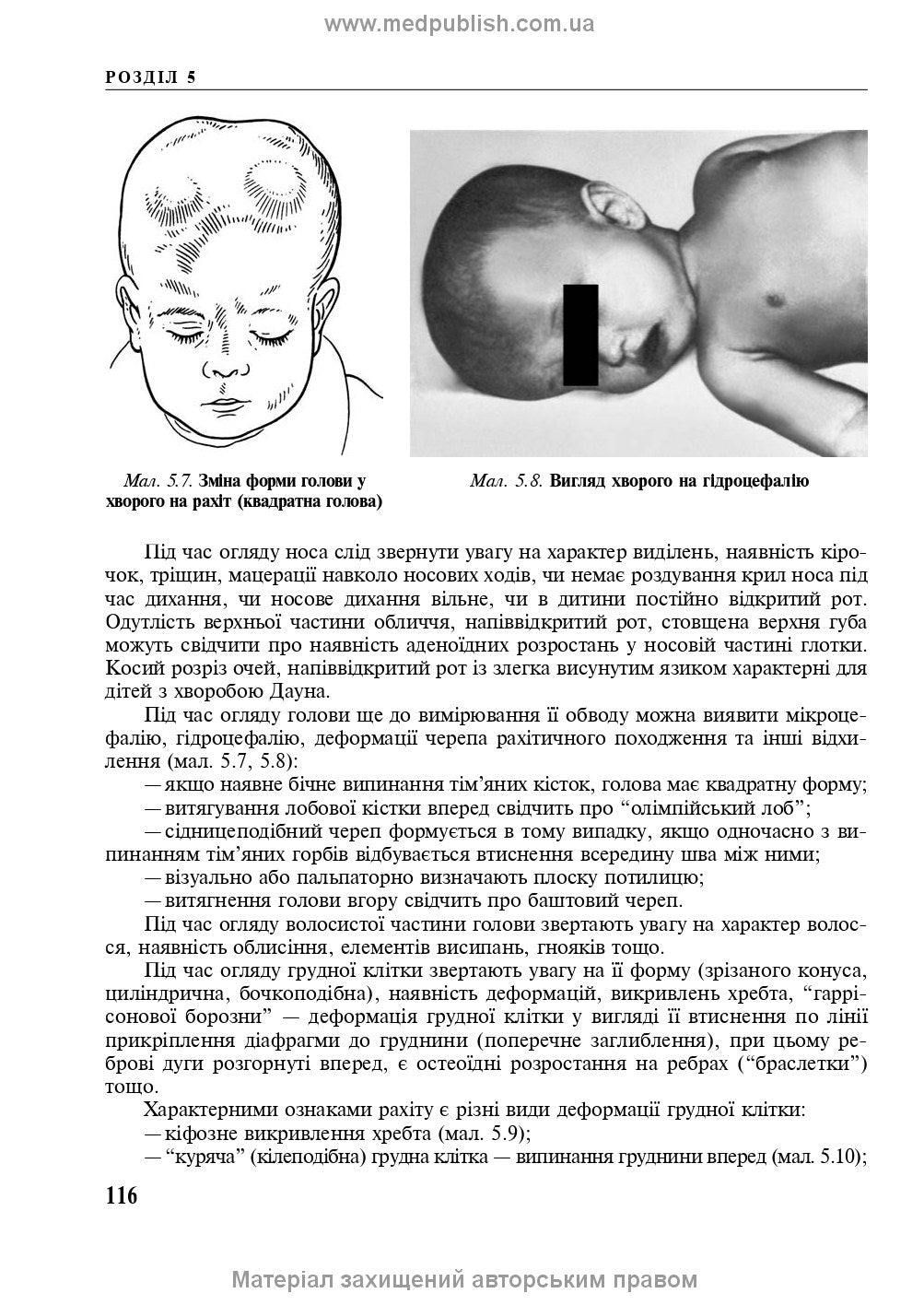 Pediatrics with a Course in Infectious Diseases: Textbook / L.V. Besh, V.I. Beldiy, L.P. Dedyshyn et al. — 9th edition