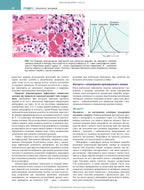 Robbins and Kumar Basic Pathology: Eleventh Edition / Vinay Kumar, Abul K. Abbas, Jon C. Aster et al.
