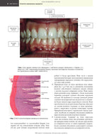 Practical Periodontology: 2nd Edition / Kenneth Eaton, Philip Ower