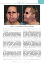 Cosmetic Dermatology: Lasers, Lights and Energy Devices: 5th Edition / Elizabeth L. Tanzi, Jeffrey S. Dover, Leisa C. Spring