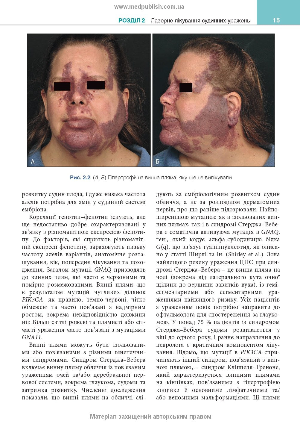 Cosmetic Dermatology: Lasers, Lights and Energy Devices: 5th Edition / Elizabeth L. Tanzi, Jeffrey S. Dover, Leisa C. Spring