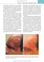 Cosmetic Dermatology: Lasers, Lights and Energy Devices: 5th Edition / Elizabeth L. Tanzi, Jeffrey S. Dover, Leisa C. Spring