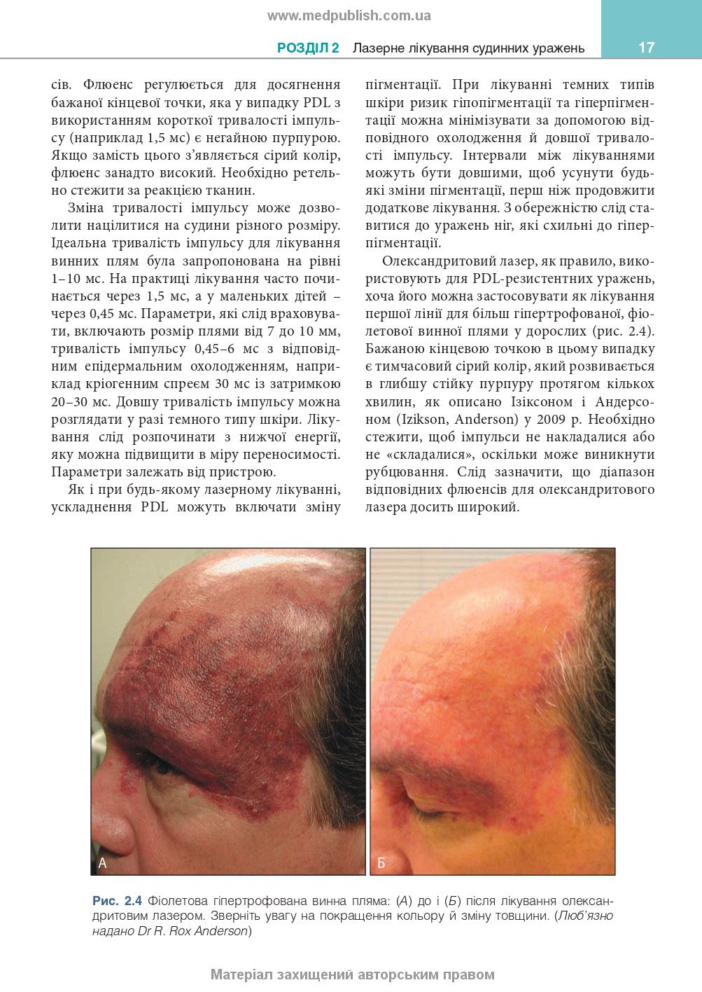 Cosmetic Dermatology: Lasers, Lights and Energy Devices: 5th Edition / Elizabeth L. Tanzi, Jeffrey S. Dover, Leisa C. Spring