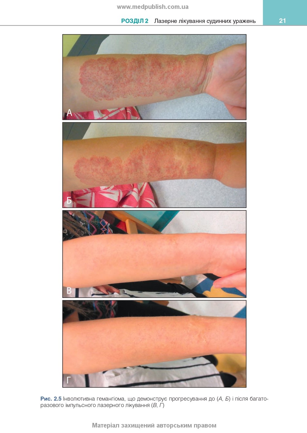 Cosmetic Dermatology: Lasers, Lights and Energy Devices: 5th Edition / Elizabeth L. Tanzi, Jeffrey S. Dover, Leisa C. Spring