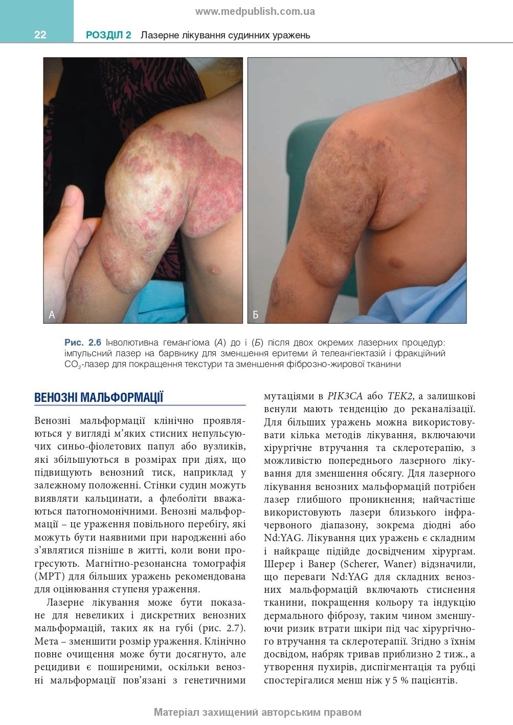 Cosmetic Dermatology: Lasers, Lights and Energy Devices: 5th Edition / Elizabeth L. Tanzi, Jeffrey S. Dover, Leisa C. Spring