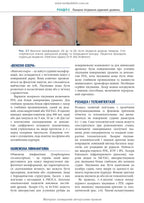 Cosmetic Dermatology: Lasers, Lights and Energy Devices: 5th Edition / Elizabeth L. Tanzi, Jeffrey S. Dover, Leisa C. Spring