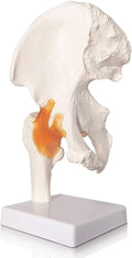 Hip joint model