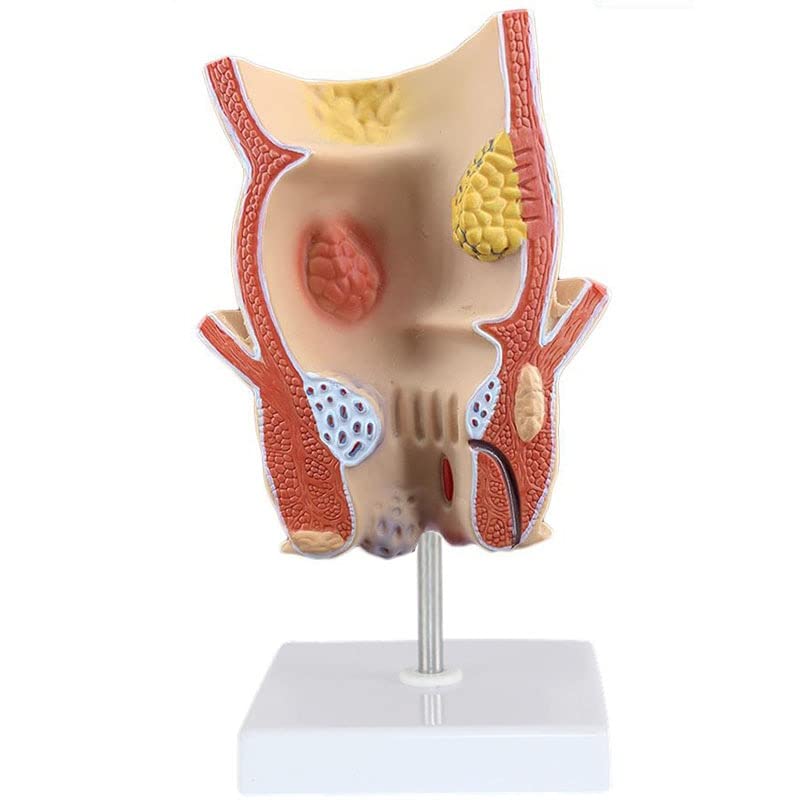 Rectum model