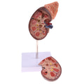 Kidney model