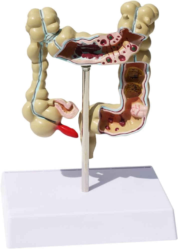 Intestine model