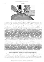 Endoscopic and Robotic Surgery: A Textbook / V.M. Zaporozhan, V.V. Grubnik, Yap Bonjer et al. — 2nd edition