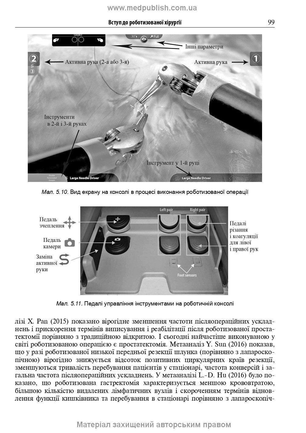 Endoscopic and Robotic Surgery: A Textbook / V.M. Zaporozhan, V.V. Grubnik, Yap Bonjer et al. — 2nd edition
