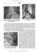 Endoscopic and Robotic Surgery: A Textbook / V.M. Zaporozhan, V.V. Grubnik, Yap Bonjer et al. — 2nd edition