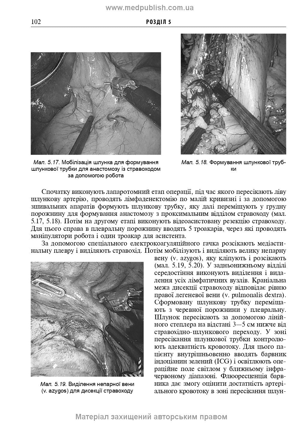 Endoscopic and Robotic Surgery: A Textbook / V.M. Zaporozhan, V.V. Grubnik, Yap Bonjer et al. — 2nd edition