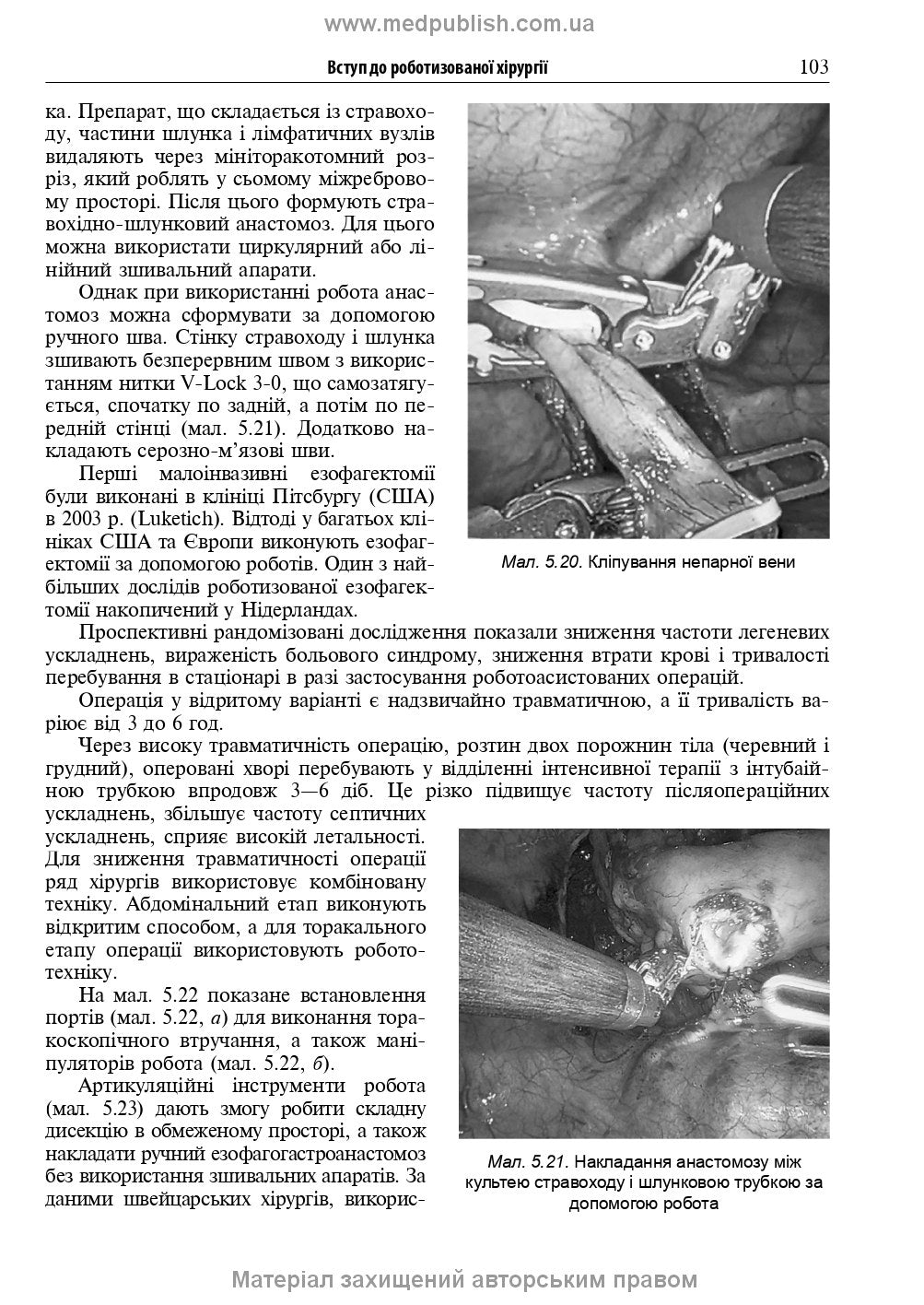 Endoscopic and Robotic Surgery: A Textbook / V.M. Zaporozhan, V.V. Grubnik, Yap Bonjer et al. — 2nd edition