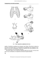 Anesthesiology and Intensive Care: textbook / F.S. Hlumcher, Yu.L. Kuchyn, S.O. Dubrov et al. — 3rd ed.