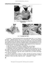 Anesthesiology and Intensive Care: textbook / F.S. Hlumcher, Yu.L. Kuchyn, S.O. Dubrov et al. — 3rd ed.