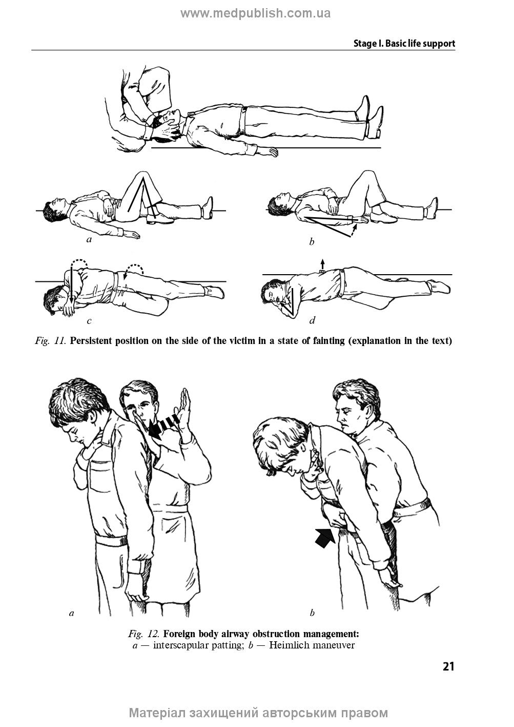 Anesthesiology and Intensive Care: textbook / F.S. Hlumcher, Yu.L. Kuchyn, S.O. Dubrov et al. — 3rd ed.