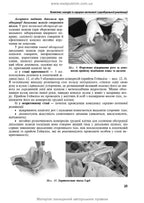 Anesthesiology and Intensive Care: Textbook / F.S. Hlumcher, L.P. Chepkyi, L.V. Novytska-Usenko et al. — 4th edition