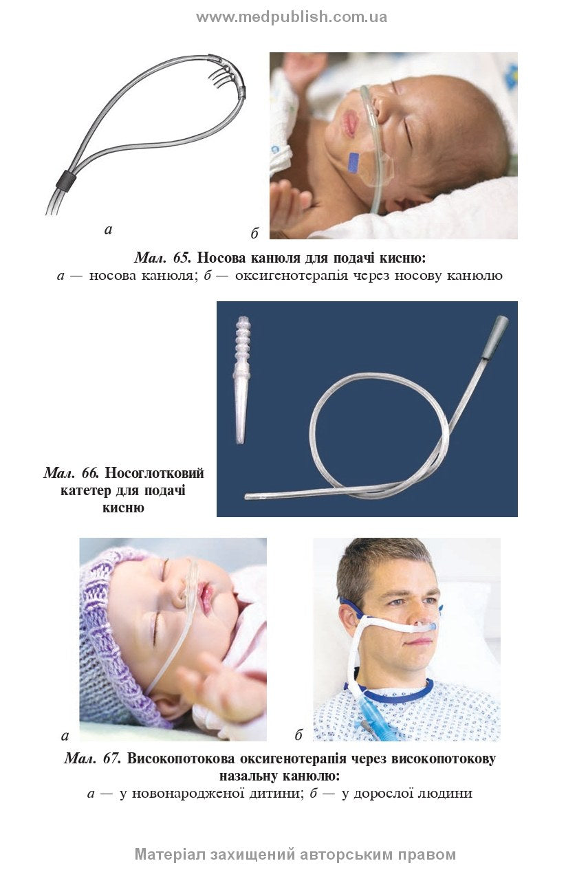 Basics of Child Care. Techniques for Medical Procedures and Manipulations: A Textbook / V.S. Berezenko, O.V. Tiazhka, A.M. Antoshkina et al. — 3rd edition
