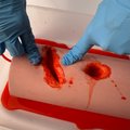WoundTamp Lapart Wound Packing Simulator